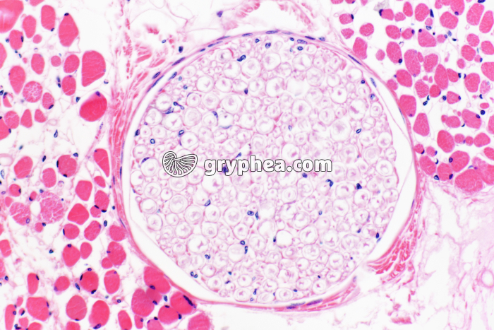 Nerf dans muscle strié CT x100 - gryphea.org